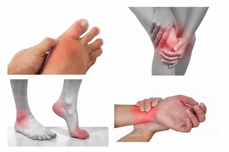hỗ trợ điều trị đau các khớp